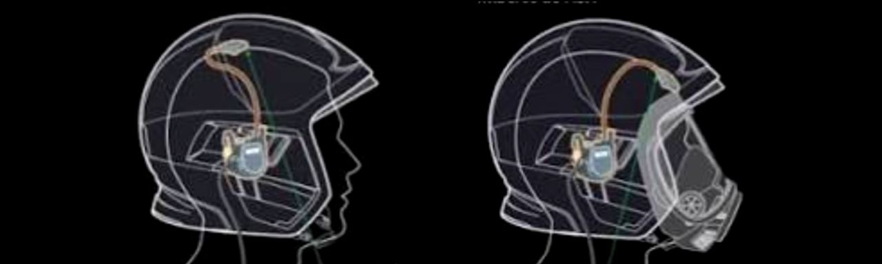 Sistema Intercraneal